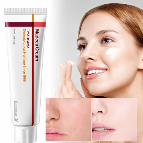Centellian24 madeca cream time - centellian24,